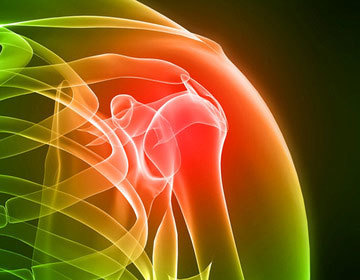 Shoulder injury after an accident